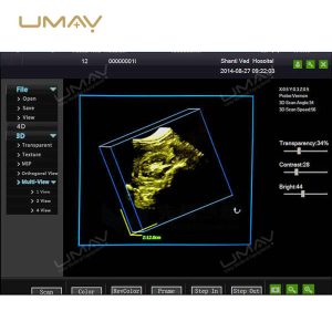 3D 4D Full Digital Trolley Doppler Ultrasound Scanner - CE Approved-9