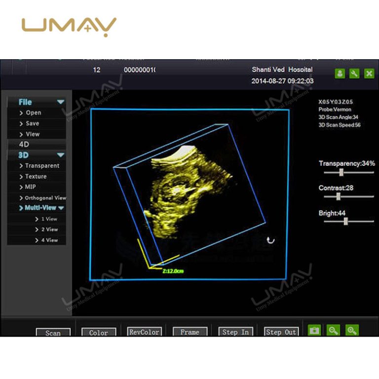 3D 4D Full Digital Trolley Doppler Ultrasound Scanner - CE Approved-9