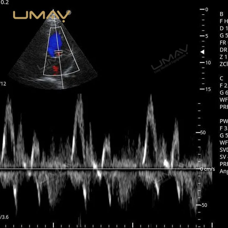 Portable Digital Color Doppler Ultrasound Machine for Human and Veterinary Use-1
