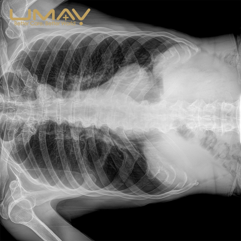 Chest radiography image captured with a digital X-ray system