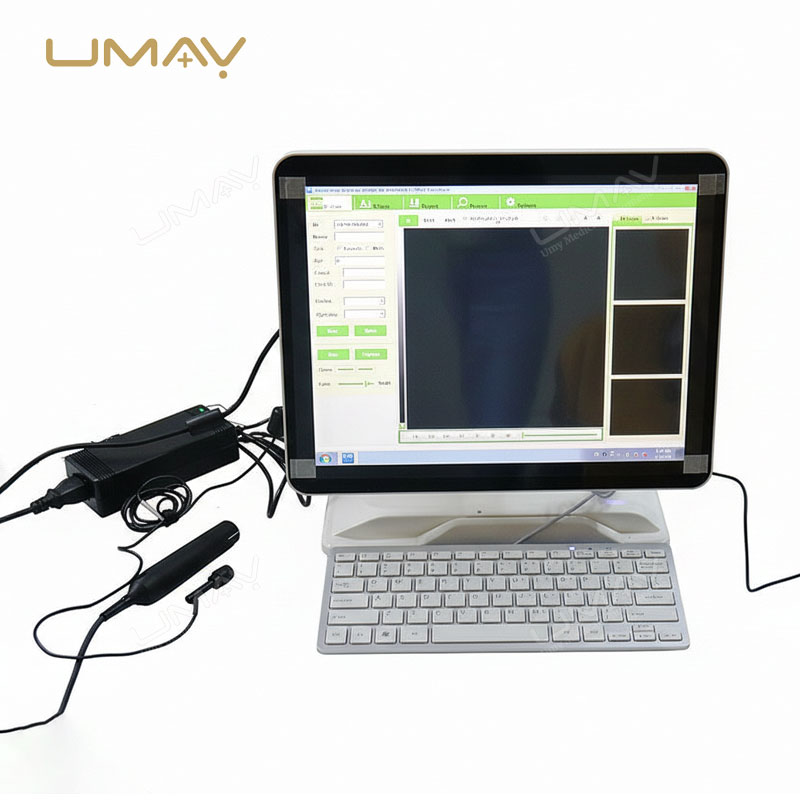 15-Inch Ophthalmic A/B Ultrasound Portable Scanner for Accurate Eye Disease Diagnosis
