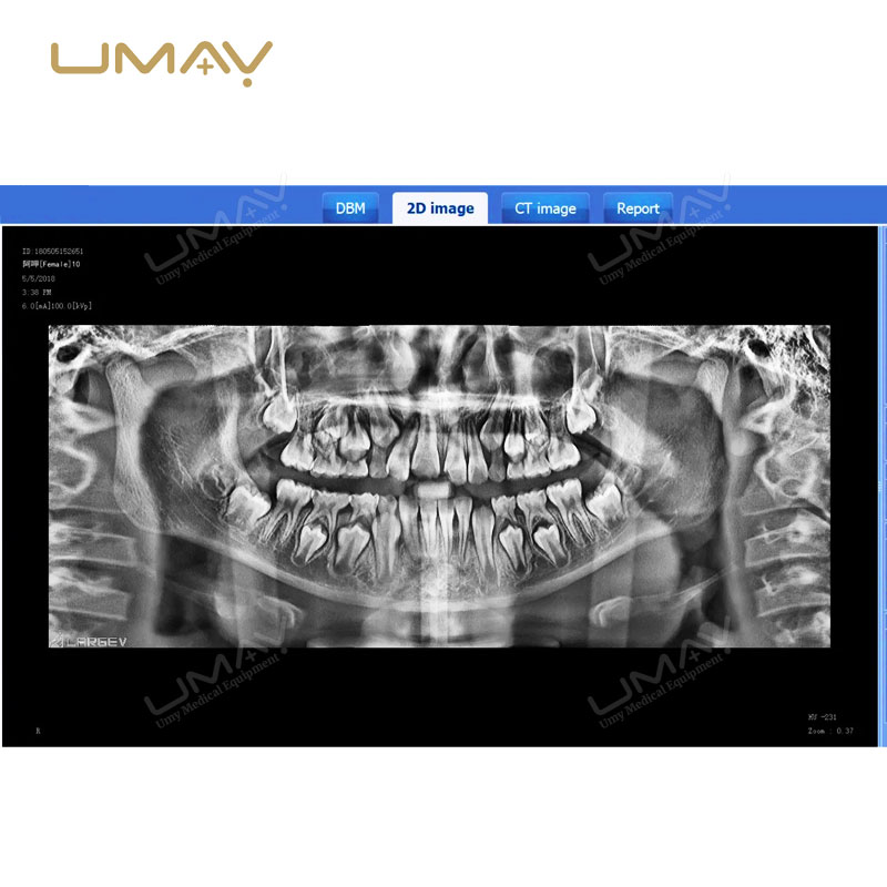 3D CBCT Dental Panoramic X-Ray Machine for Fine-Detail Imaging