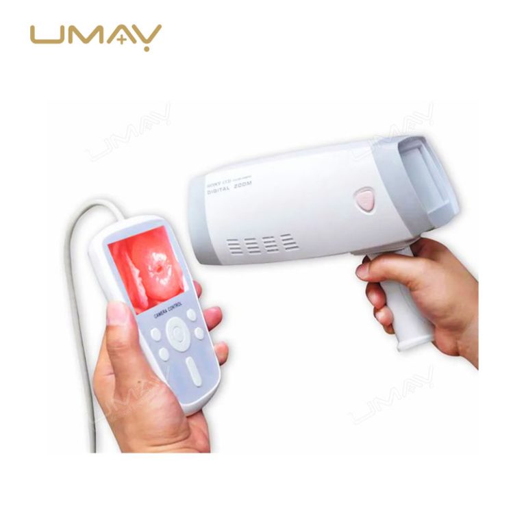 Portable Digital Video Colposcope for Gynecological Examinations in High Demand