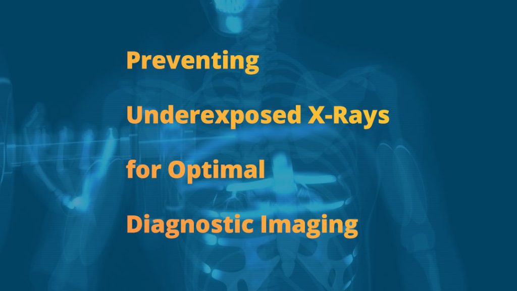 A digital X-ray background with the text ‘Preventing Underexposed X-Rays for Optimal Diagnostic Imaging,’ emphasizing the importance of proper exposure settings in radiology.