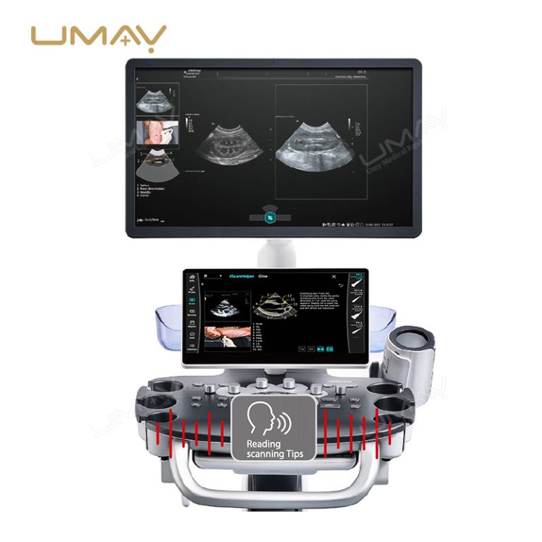 Veterinary Ultrasound Machine Vetus 60 for Multi-Species Imaging and Diagnosis-2