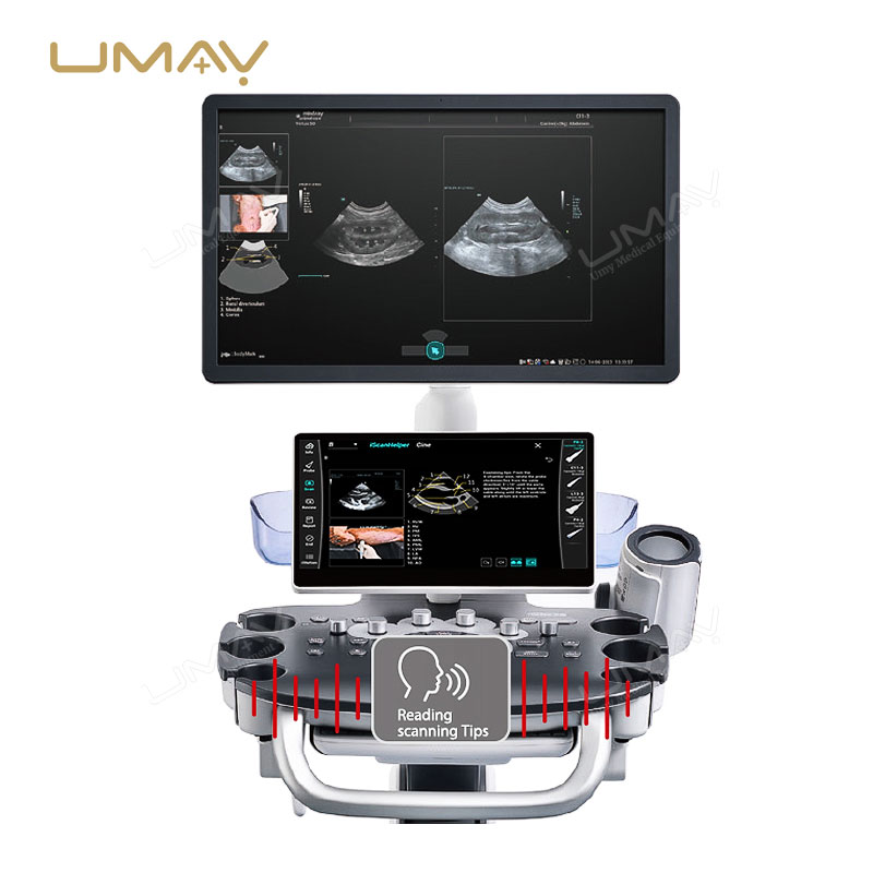 Veterinary Ultrasound Machine Vetus 60 for Multi-Species Imaging and Diagnosis-6
