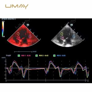 Vetus 8EXP Veterinary 3D 4D Ultrasound System for Advanced Animal Imaging-3