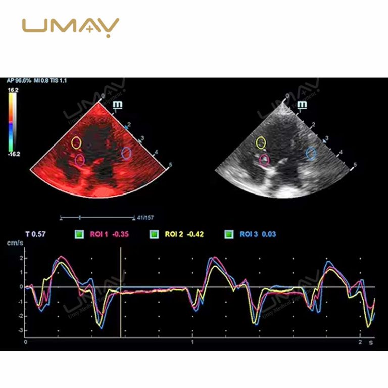 Vetus 8EXP Veterinary 3D 4D Ultrasound System for Advanced Animal Imaging-3