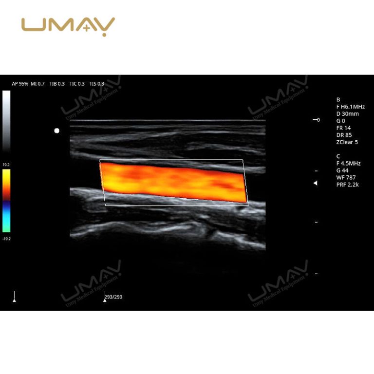 3D and 4D Color Doppler Ultrasound Machine Trolley for Fine-Detail Imaging-10