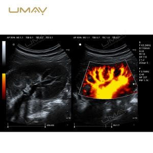 3D and 4D Color Doppler Ultrasound Machine Trolley for Fine-Detail Imaging-5