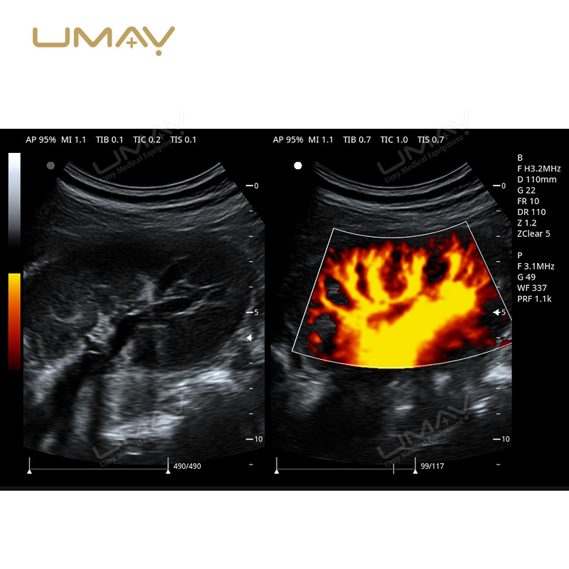 3D and 4D Color Doppler Ultrasound Machine Trolley for Fine-Detail Imaging