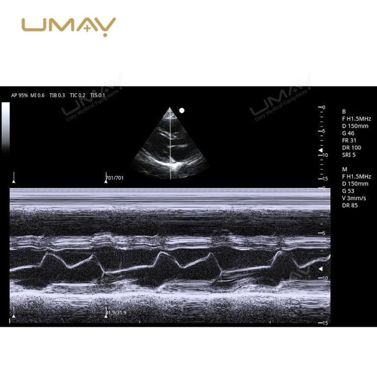 3D and 4D Color Doppler Ultrasound Machine Trolley for Fine-Detail Imaging-6