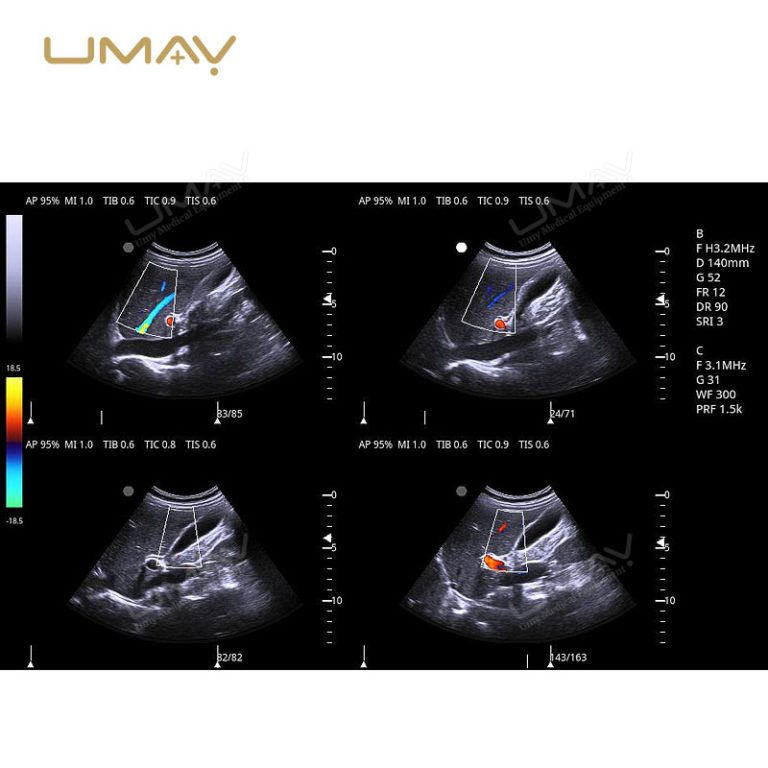 3D and 4D Color Doppler Ultrasound Machine Trolley for Fine-Detail Imaging-7