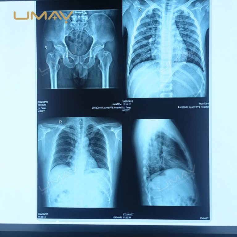 Digital DICOM Image Inkjet Printer for X Ray Film with Smart Value Integration-2
