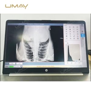 Digital DICOM Image Inkjet Printer for X Ray Film with Smart Value Integration-8
