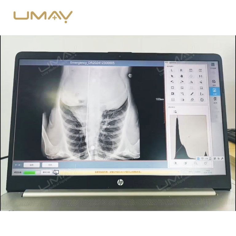 Digital DICOM Image Inkjet Printer for X Ray Film with Smart Value Integration-8