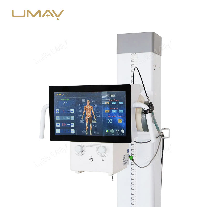 High Frequency 32kW Stationary Medical DR X-ray System for Hospital Imaging