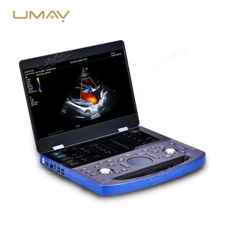 Vetus E7 Hand Carried Veterinary Ultrasound System for On-the-Go Animal Diagnostics-2