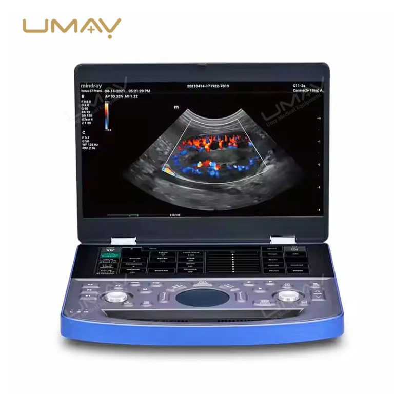 Vetus E7 Hand Carried Veterinary Ultrasound System for On-the-Go Animal Diagnostics-3