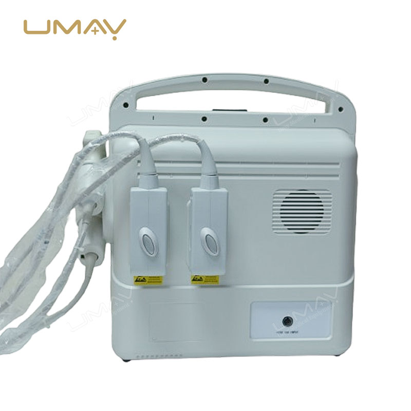 3D 4D Color Doppler Ultrasound Portable Scanner for Obstetrics, Cardiology, and Abdominal Imaging UMY-US-051