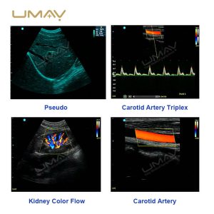 3D 4D Color Doppler Ultrasound Portable Scanner for Obstetrics, Cardiology, and Abdominal Imaging-8