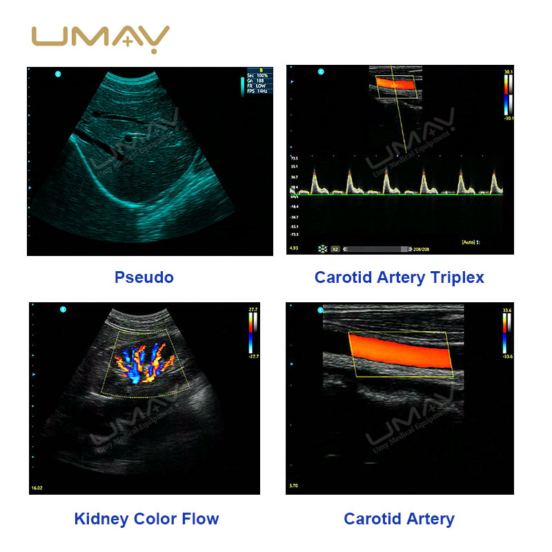 3D 4D Color Doppler Ultrasound Portable Scanner for Obstetrics, Cardiology, and Abdominal Imaging UMY-US-051