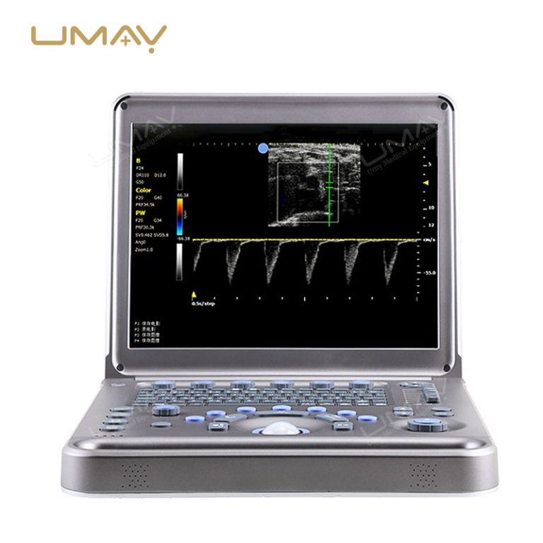 Portable Full-Digital Veterinary Ultrasound Scanner with High-Resolution Imaging and Wireless Probes-2