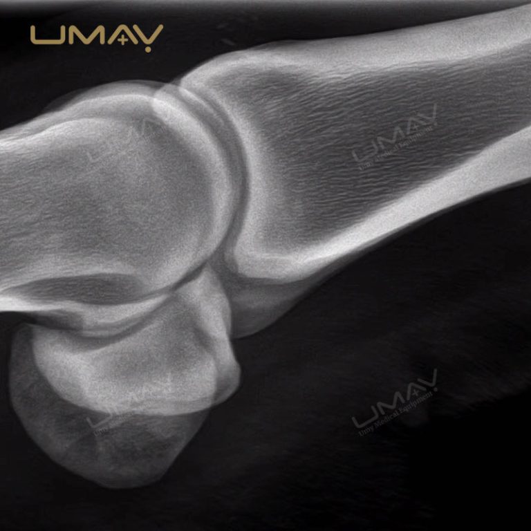 1kW Lightweight X Ray Imaging System for Human and Animal Diagnosis with Touch Control-5