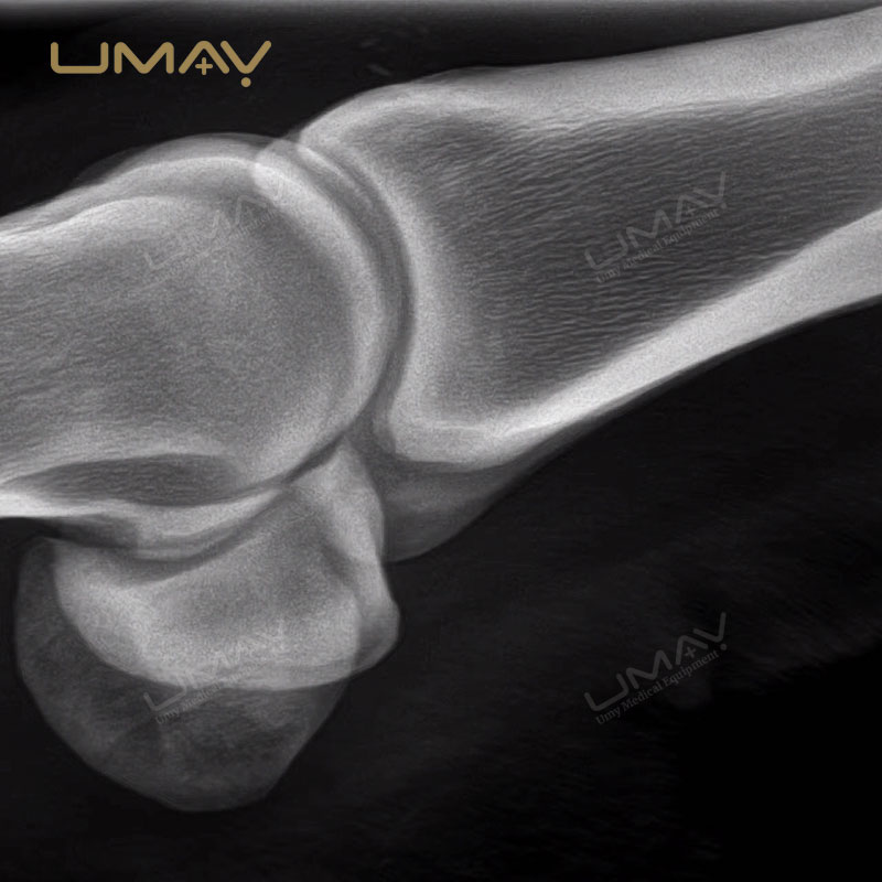 1kW Lightweight X Ray Imaging System for Human and Animal Diagnosis with Touch Control