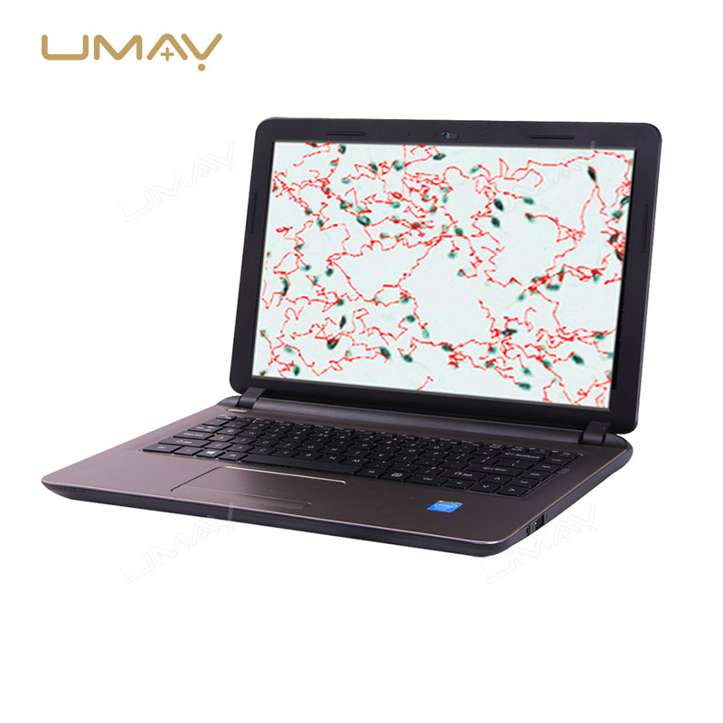 Animal Semen Analyzer for Veterinary Fertility Evaluation with Computer