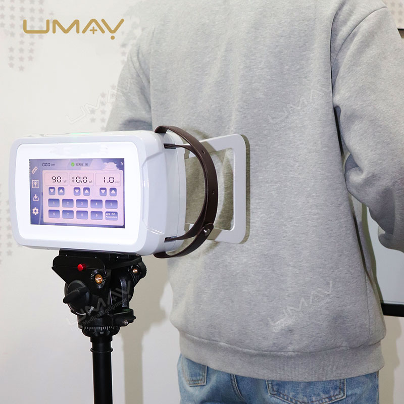 Compact Digital X-ray Machine 90kV with Versatile Imaging for Medical and Vet Use