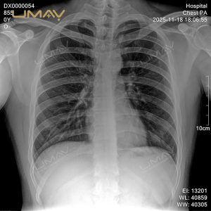 Compact Digital X-ray Machine 90kV with Versatile Imaging for Medical and Vet Use-15