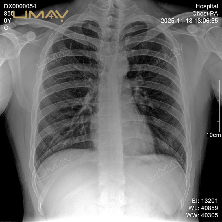 Compact Digital X-ray Machine 90kV with Versatile Imaging for Medical and Vet Use-15