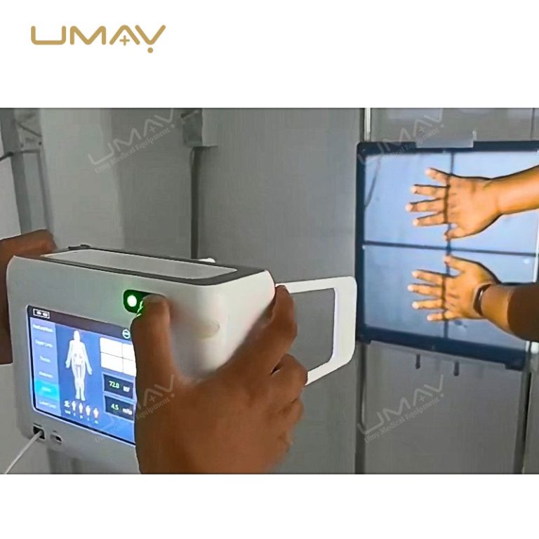 Handheld Portable X Ray Unit with Remote Control and Long Battery Life-1