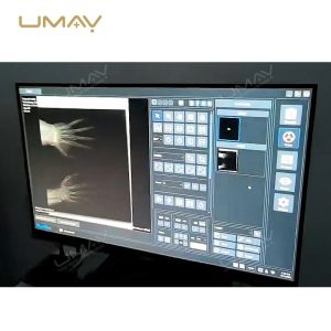 Handheld Portable X Ray Unit with Remote Control and Long Battery Life-2