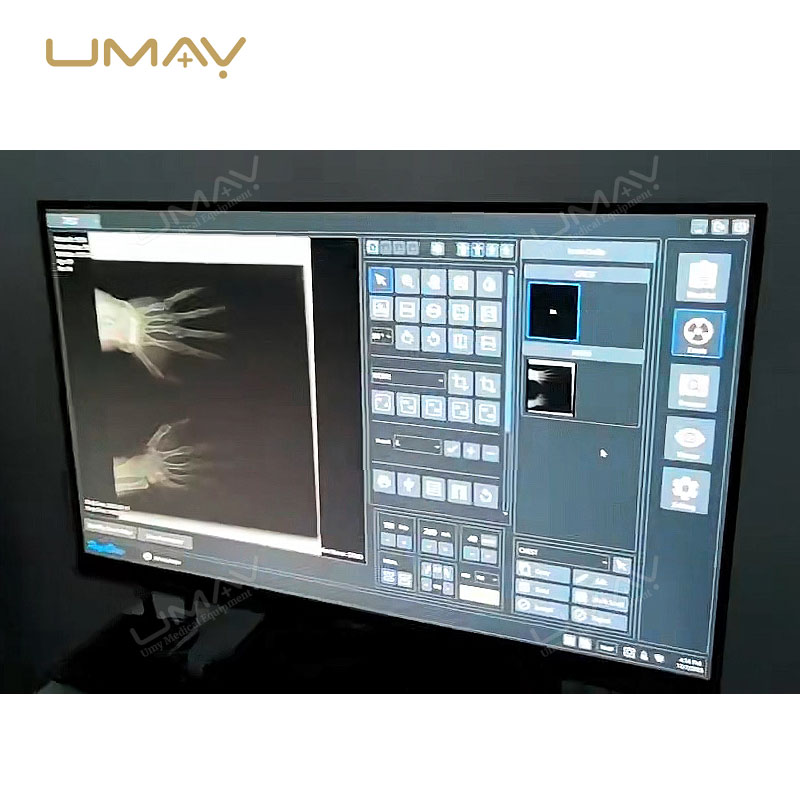 Handheld Portable X Ray Unit with Remote Control and Long Battery Life