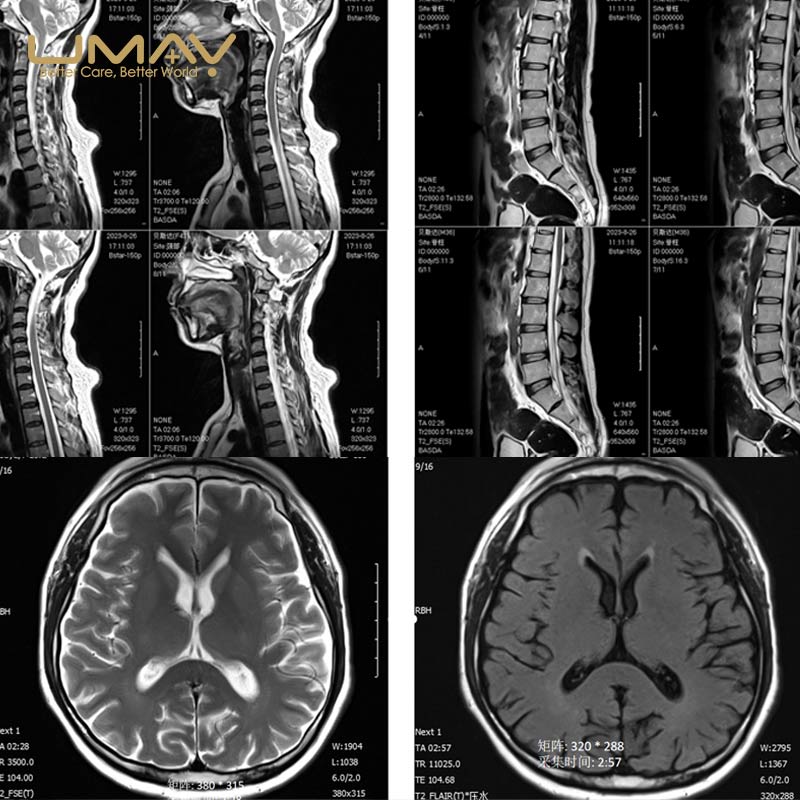 UMY-MRI-15 1.5T Superconducting MRI System with 16-Channel RF - Image 4