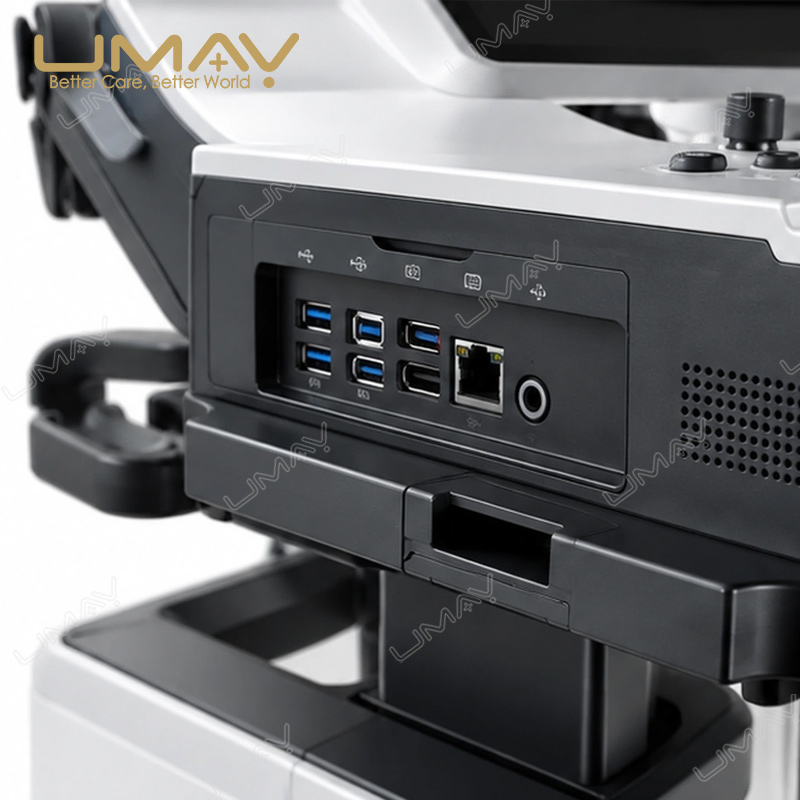 Mindray Consona N5 Diagnostic Ultrasound System for Multi-Specialty Imaging - Image 3